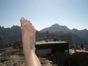 A sore foot?