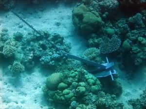 Overview of anchor placement